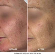 Load image into Gallery viewer, SIMKA Skin Clarity Bio-Cellulose Mask 4pk