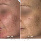 SIMKA Skin Clarity Bio-Cellulose Mask