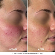 Load image into Gallery viewer, SIMKA Vitamin Infusion Bio-Cellulose Facial Mask 4pk
